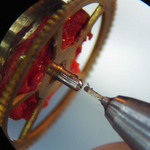 image type L 1/1
